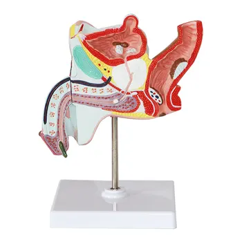 Модель мужской гонореи, анатомическая модель мужских репродуктивных органов, мочекаменный камень, модель остроконечных кондилом, урологическая хирургия Изображение